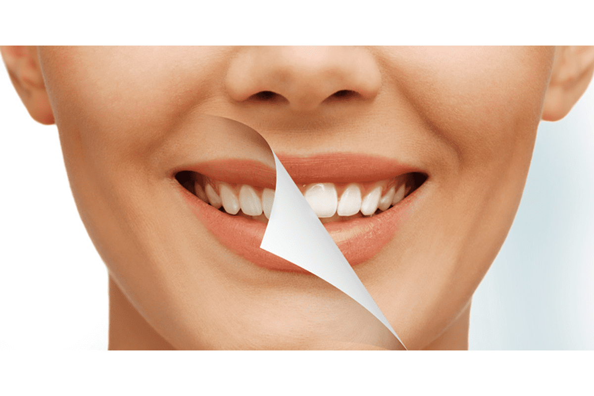 Cosmetic Dentistry Lake in the hills IL