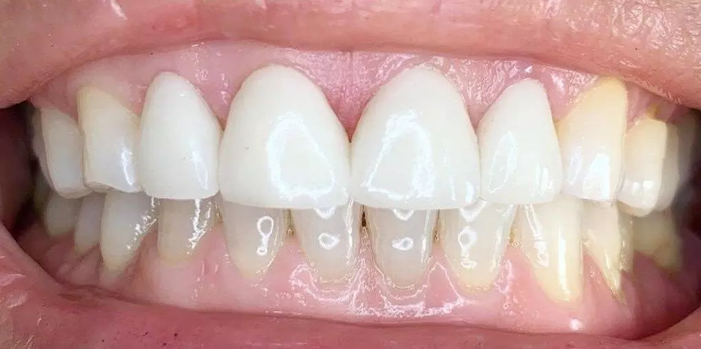 Family Dentistry Marengo IL