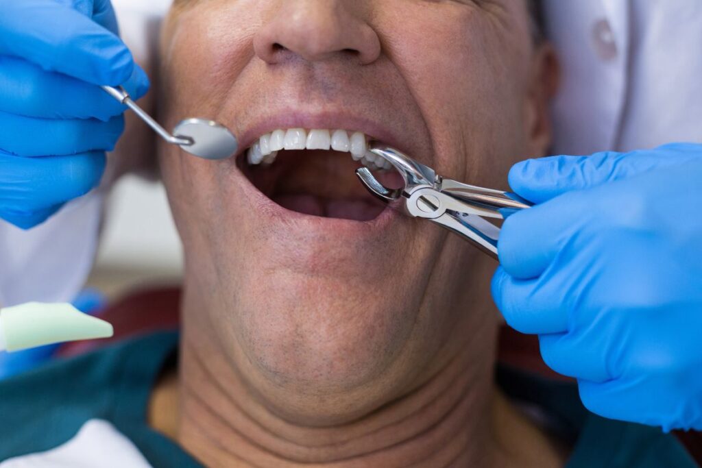 Dentist extracting a tooth using forceps while patient sits in dental chair.