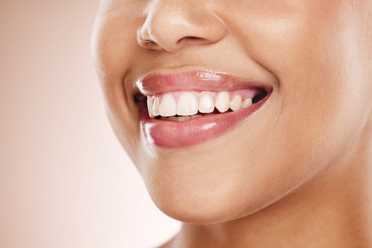 Close-up of a patient smiling after cosmetic dental treatment.