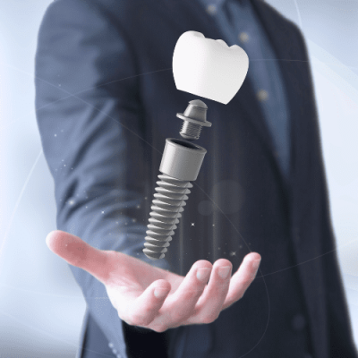 Dental implant with crown component displayed in a dentist's hand representing tooth replacement.