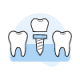 Dental implant illustration showing two natural teeth flanking a dental implant with blue crown.