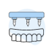 Dental implant crown illustration showing implant fixture and prosthetic tooth restoration.